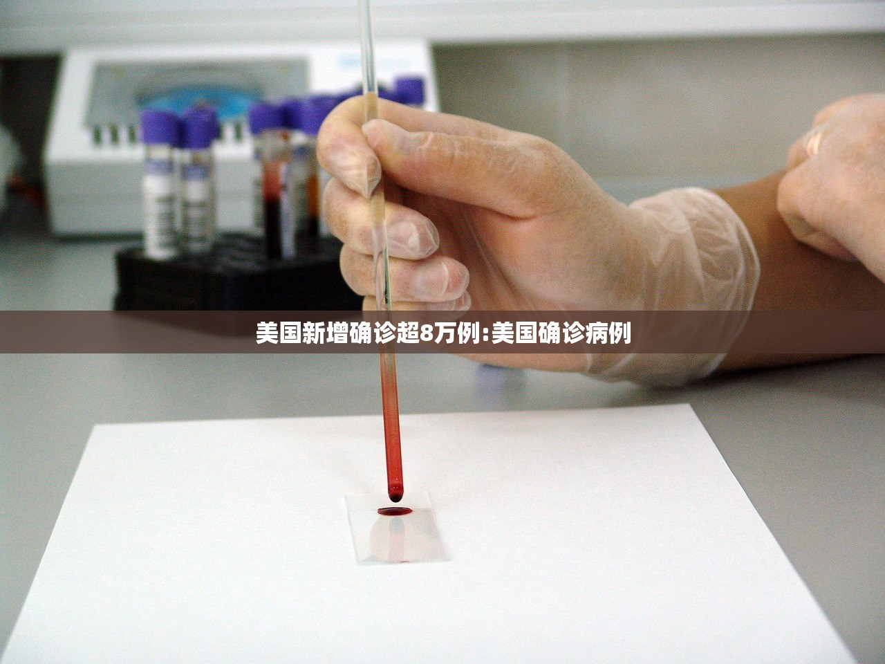 美国新增确诊超8万例:美国确诊病例