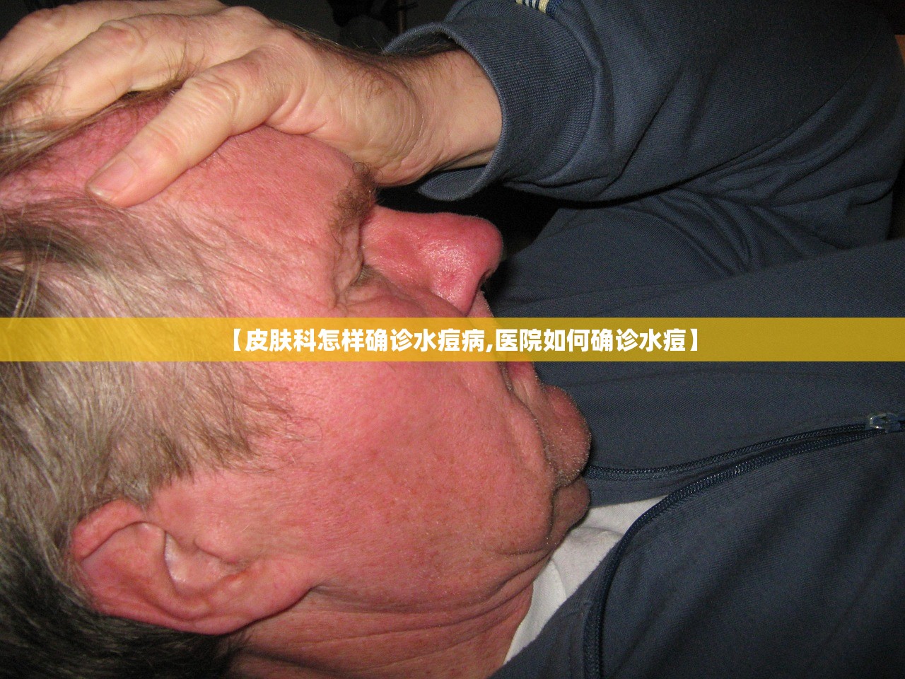 【皮肤科怎样确诊水痘病,医院如何确诊水痘】 【皮肤科怎样确诊水痘病,医院如何确诊水痘】