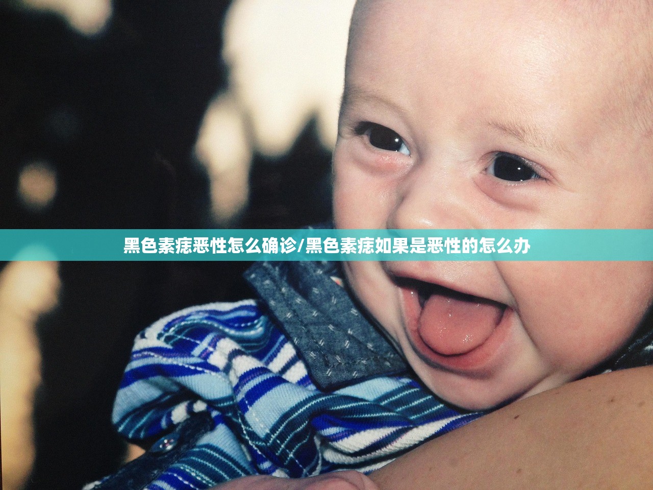 黑色素痣恶性怎么确诊/黑色素痣如果是恶性的怎么办 黑色素痣恶性怎么确诊/黑色素痣如果是恶性的怎么办