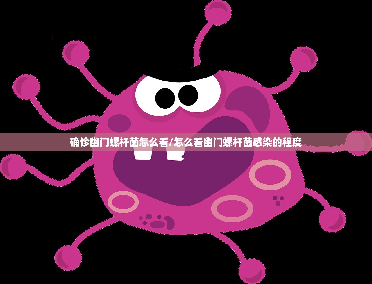 确诊幽门螺杆菌怎么看/怎么看幽门螺杆菌感染的程度